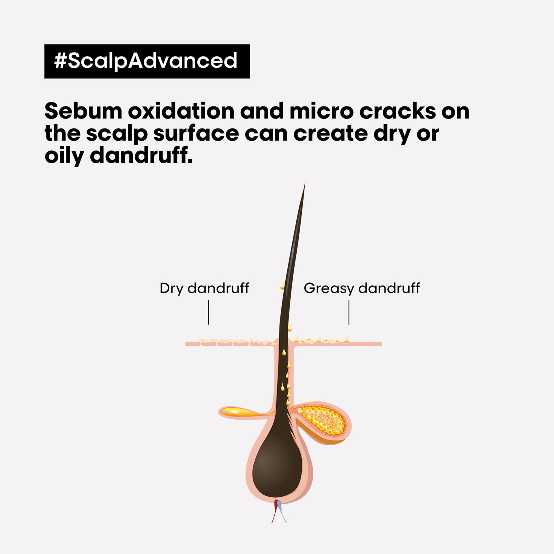 scalp-advanced-Arcilla antigrasa purificadora profunda 2&nbsp;en&nbsp;1-7